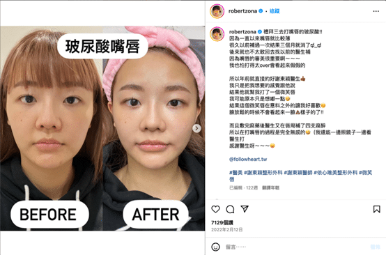 醫美網紅行銷案例